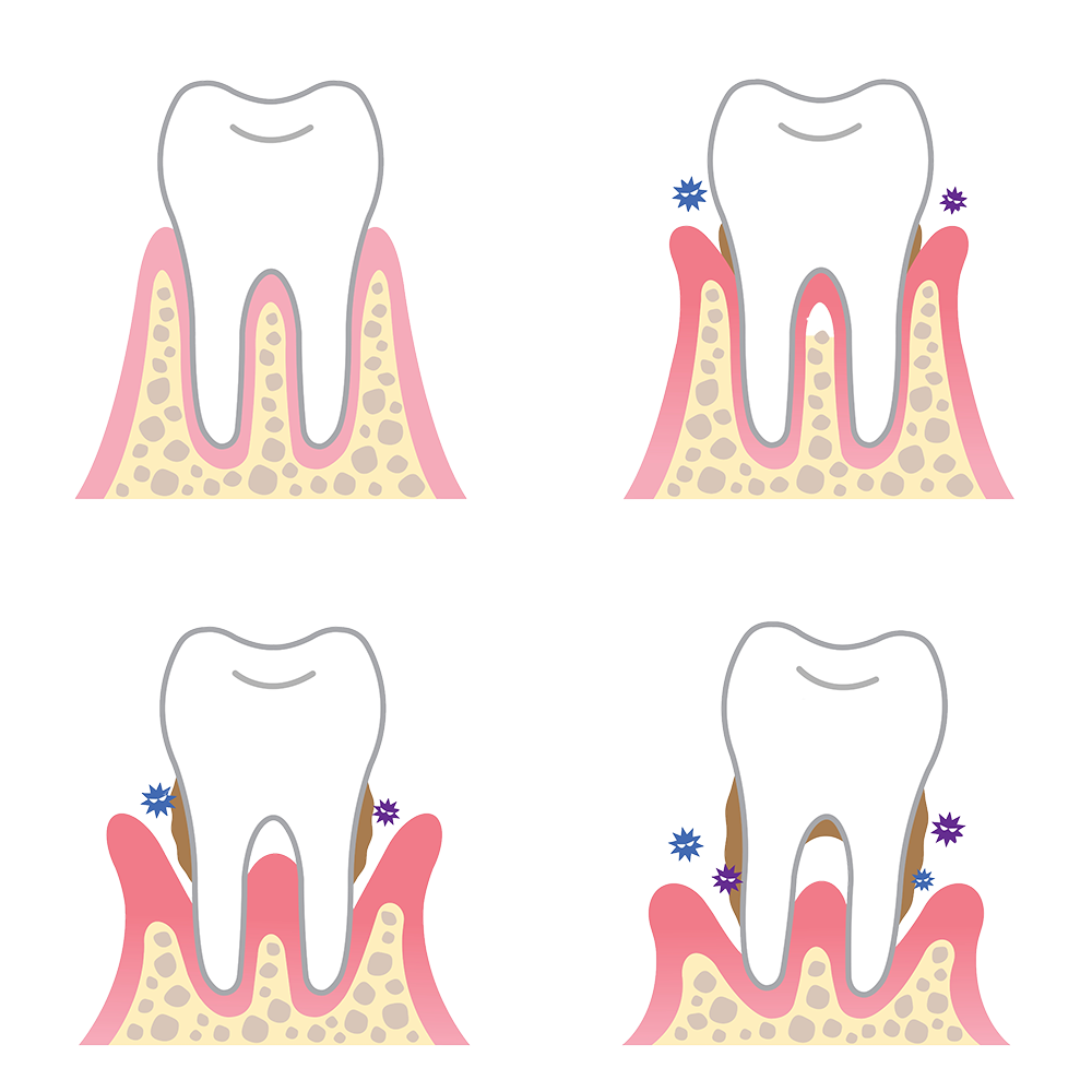 Η θεραπευτική οδοντιατρική στοχεύει στην αποκατάσταση της λειτουργικότητας του στοματογναθικού συστήματος. Περιλαμβάνει ένα ευρύτατο φάσμα δραστηριοτήτων μερικές από τις οποίες μπορούν να σας αφορούν άμεσα. CC Dental