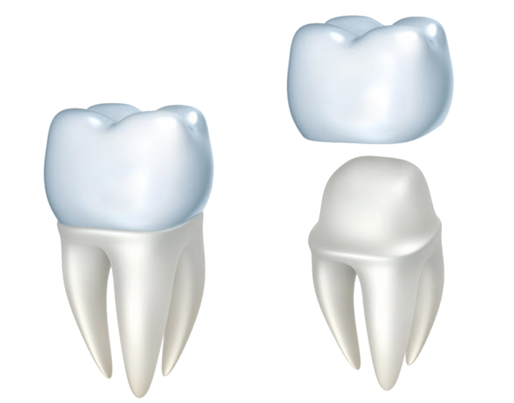 Η αισθητική οδοντιατρική στοχεύει στη βελτίωση της εμφάνισης ενός χαμόγελου. Σε μερικές περιπτώσεις συνοδεύεται από ανάλογη βελτίωση της λειτουργικότητας. CC Dental