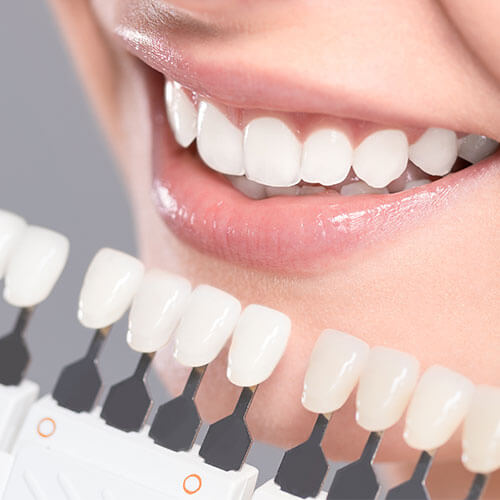 Η αισθητική οδοντιατρική στοχεύει στη βελτίωση της εμφάνισης ενός χαμόγελου. Σε μερικές περιπτώσεις συνοδεύεται από ανάλογη βελτίωση της λειτουργικότητας. CC Dental